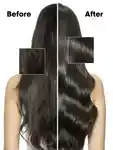 Alternative Image L Oreal Professionnel Scalp Advanced Serum