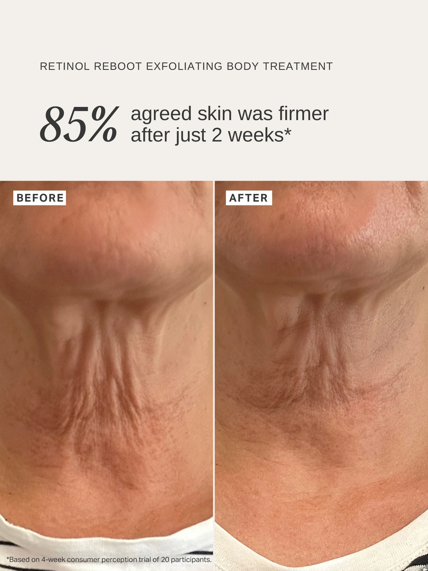 Alternative Image Alpha H Retinol Reboot Serum