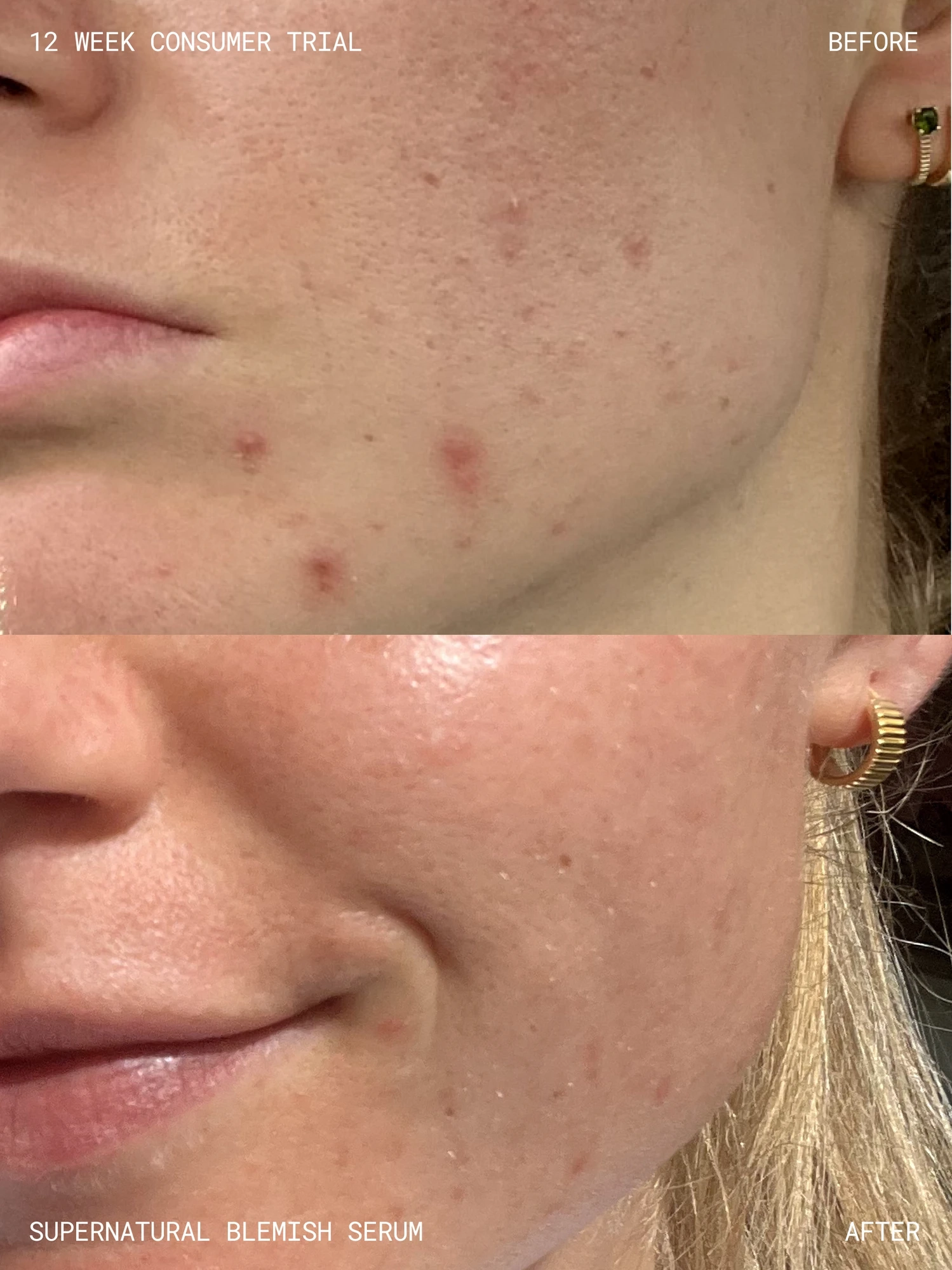 Alternative Image Emma Lewisham Supernatural Blemish Serum