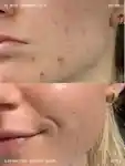 Alternative Image Emma Lewisham Supernatural Blemish Serum