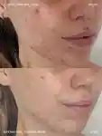 Alternative Image Emma Lewisham Supernatural Blemish Serum