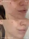 Alternative Image Emma Lewisham Supernatural Blemish Serum