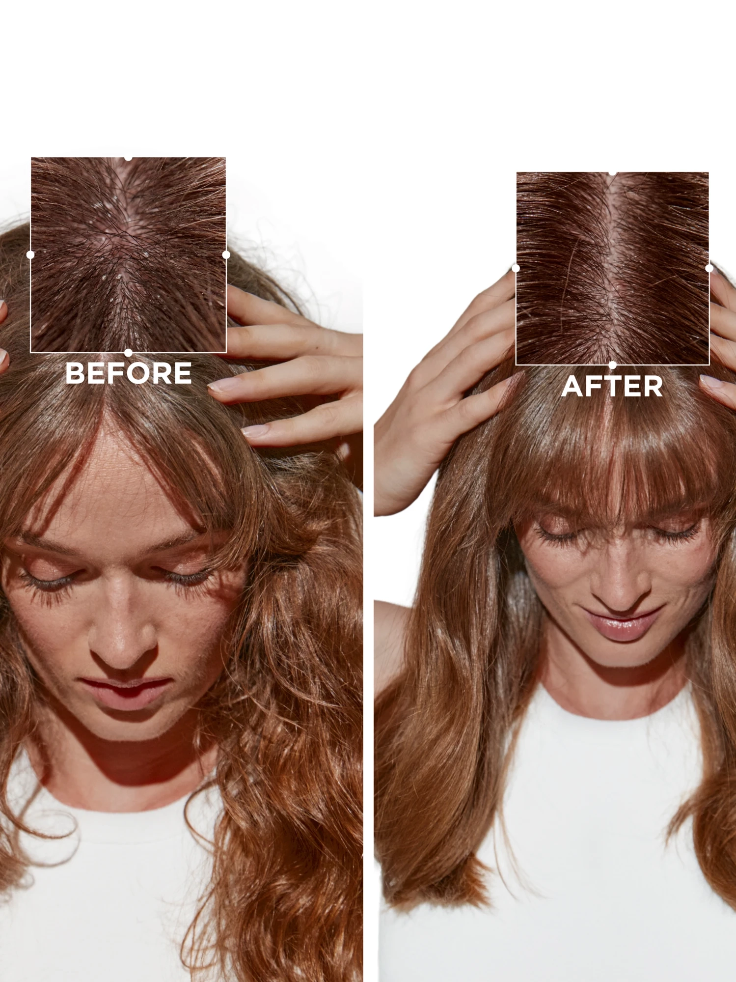 Alternative Image Kerastase Symbiose Serum