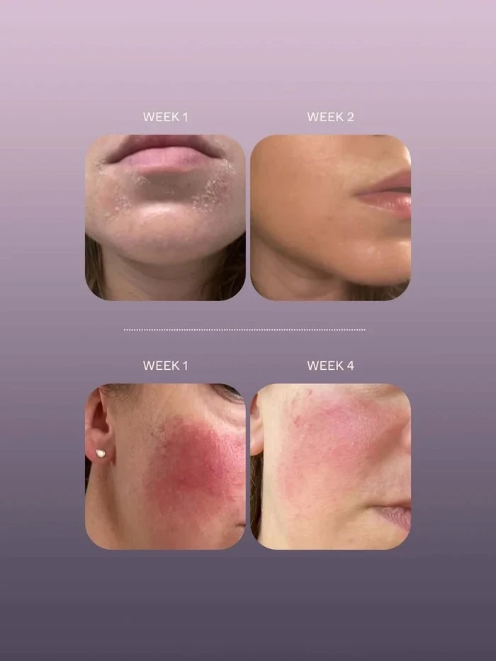 Alternative Image Herbar The Face Oil