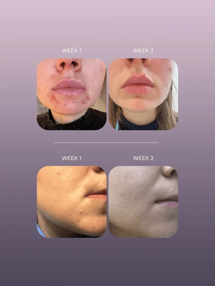 Alternative Image Herbar The Face Nectar