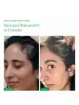 Alternative Image The Nue Co Supa Thick Scalp Serum