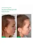 Alternative Image The Nue Co Supa Thick Scalp Serum