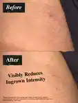 Alternative Image Kiehls Ingrown Hair And Tone Correcting Intimate Drops