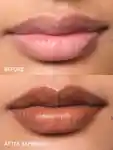 Alternative Image Glossier Balm Dotcom Lip Balmand Skin Salve
