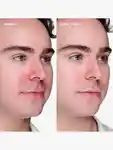Alternative Image CLINIQUE Anti Blemish Solutions10ml