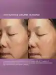 Alternative Image Dermalogica Stressed Skin Recovery System