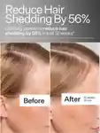 Alternative Image Act Acre 3 Pack Stem Cell