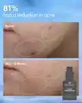 Alternative Image Origins Clear Improvement Blemish Clearing Hydrating Lotion