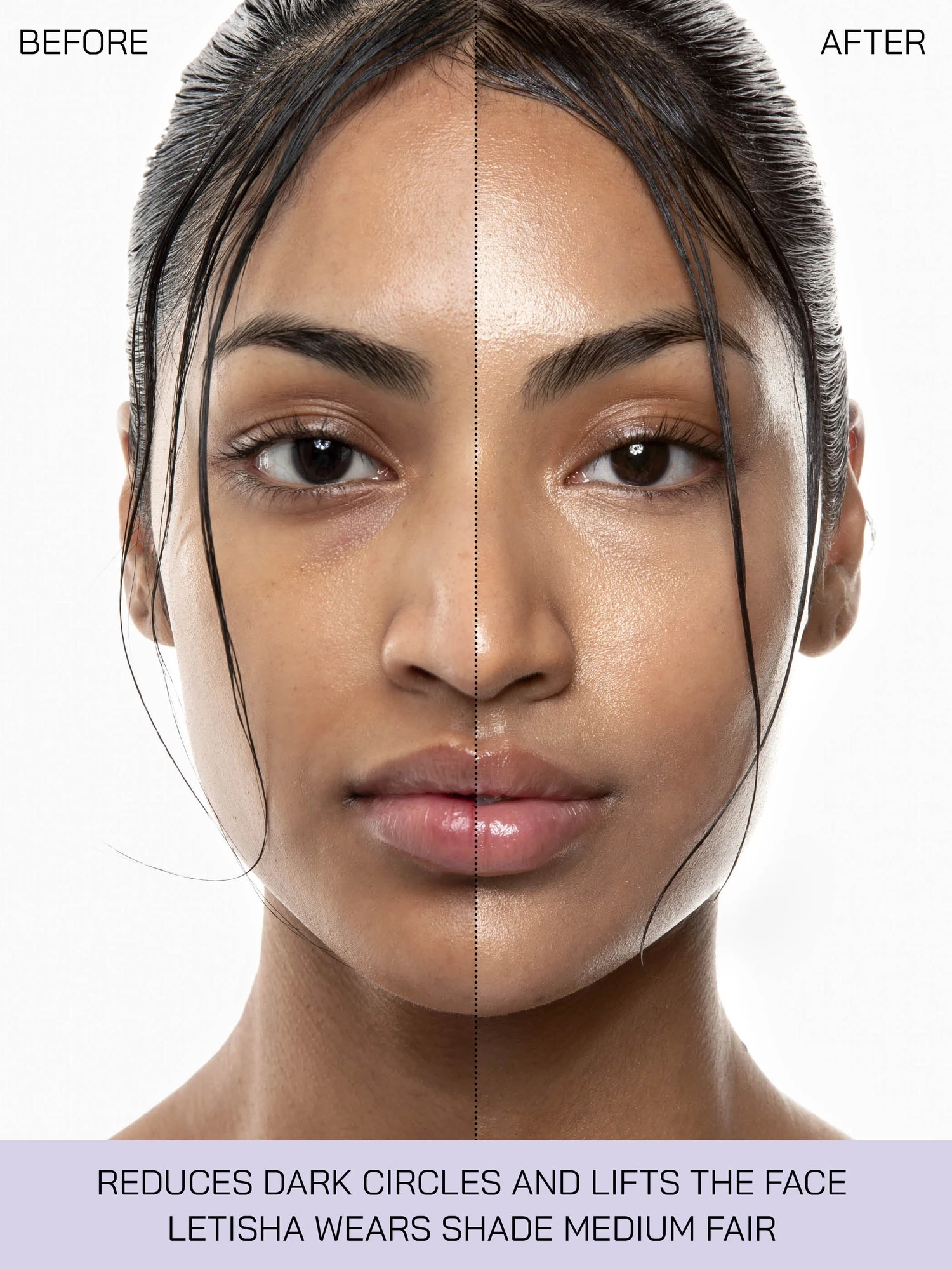 Alternative Image ISAMAYA5 Point Lift
