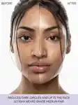 Alternative Image ISAMAYA5 Point Lift