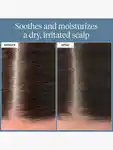 Alternative Image Briogeo Scalp Revival Rosemary Pre Wash Oil