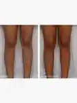 Alternative Image DRDENNISGROSS Alpha Beta Glow Pad Self Tanner For Body