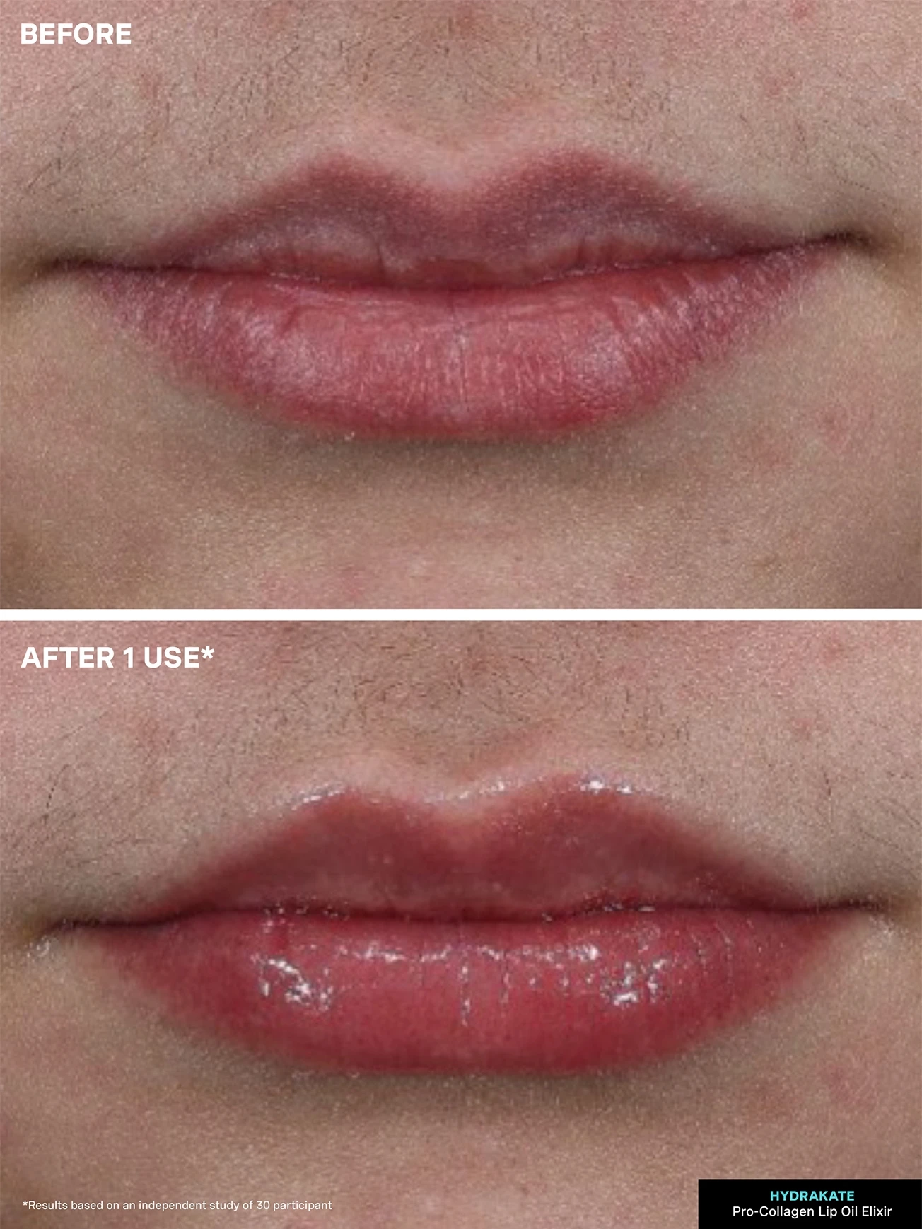 Alternative Image KATESOMERVILLE Hydra Kate Lip Oil Elixir
