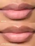Alternative Image Glossier Balm Dotcom Lip Balmand Skin Salve