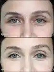 Alternative Image RMS Beauty Revitalize Hydra Concealer