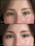 Alternative Image RMS Beauty Revitalize Hydra Concealer