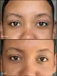 Alternative Image RMS Beauty Revitalize Hydra Concealer