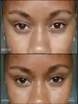 Alternative Image RMS Beauty Revitalize Hydra Concealer