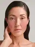 Alternative Image KARUNA Collagen Hydrogel Eye Cheek Patches
