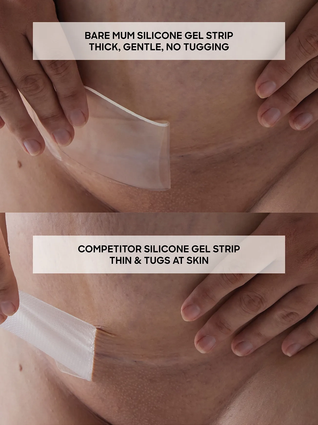 Alternative Image Bare Mum Silicone Gel Scar Strips