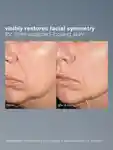 Alternative Image DERMALOGICA Neurotouch Symmetry Serum