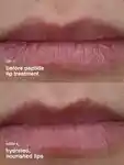 Alternative Image Rhode Peptide Lip Treatment (2)
