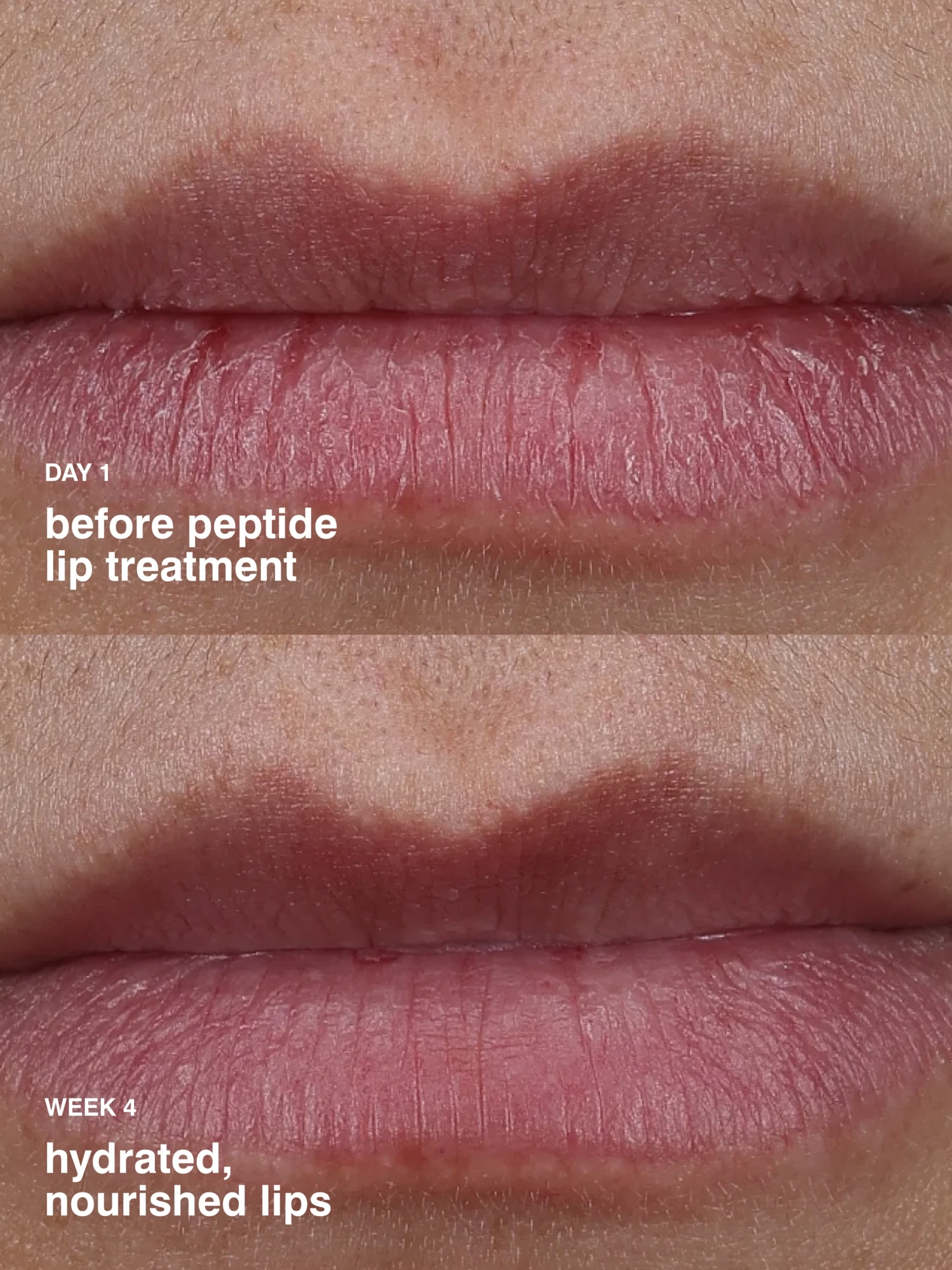 Alternative Image Rhode Peptide Lip Treatment (2)