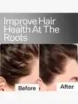 Alternative Image Act Acre Scalp Relief System