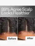 Alternative Image Act Acre Scalp Relief System