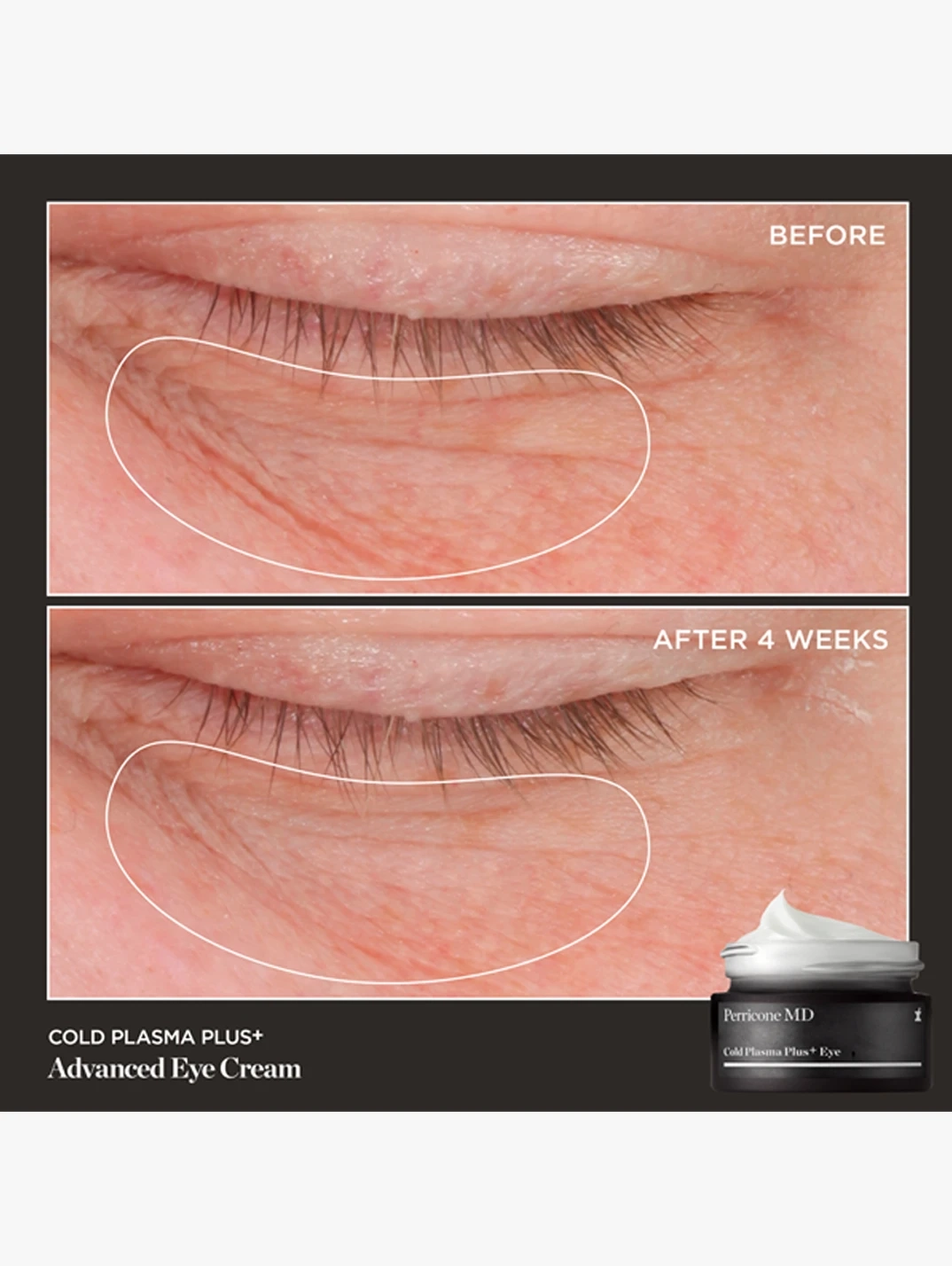 Alternative Image PERRICONEMD Cold Plasma Plus Power Quad Kit