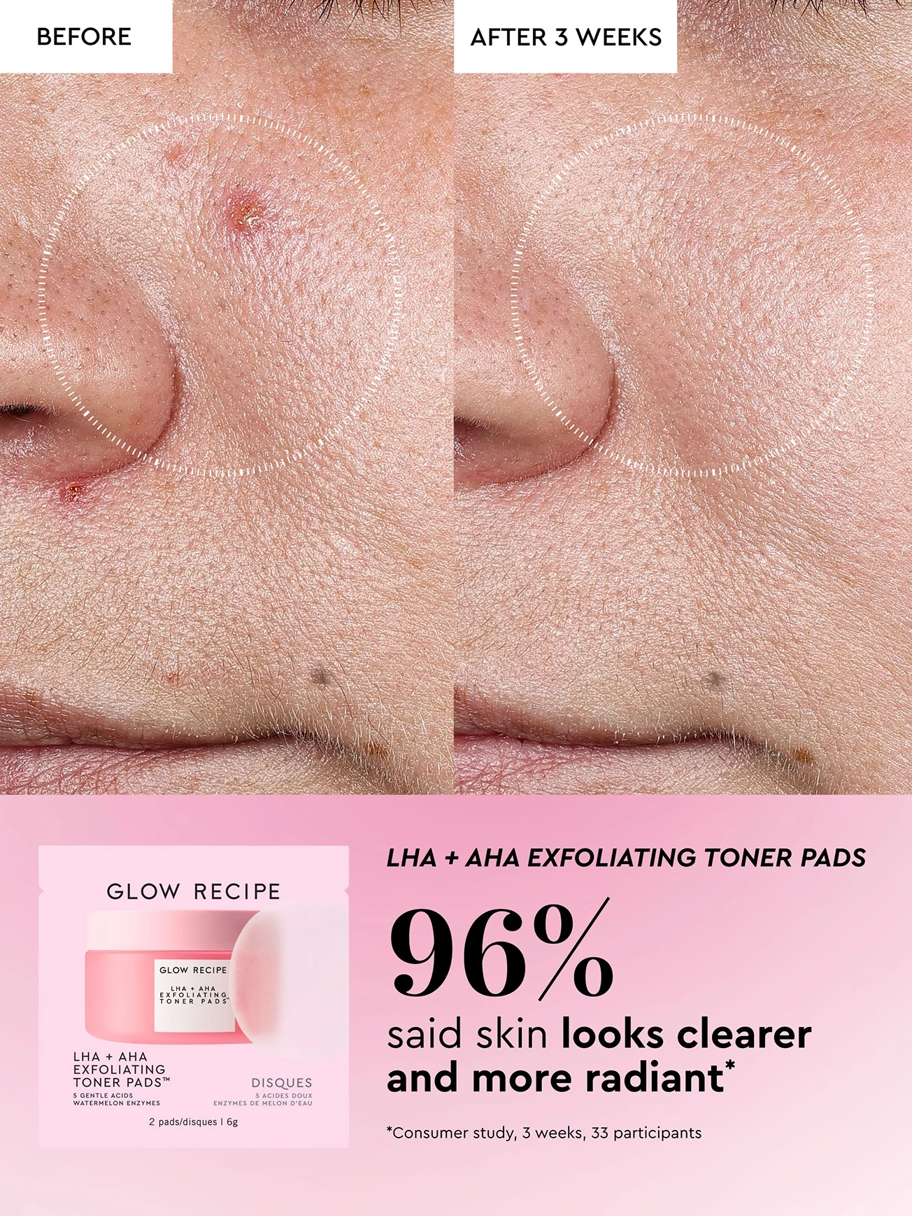 Alternative Image GLOWRECIPE Toner Pad Mini Kit