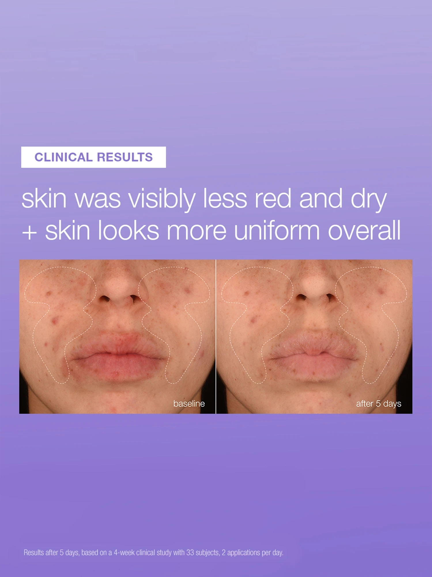 Alternative Image DERMALOGICA Stabilizing Repair Serum
