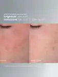 Alternative Image DERMALOGICA 90 Days Of Smooth Skin