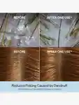 Alternative Image Briogeo Scalp Revival Dandruff Relief Shampoo