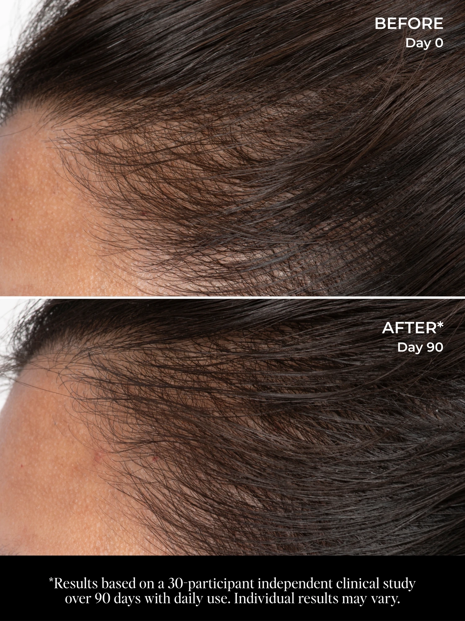 Alternative Image Lola Vie Let There Be Hair Scalp Serum