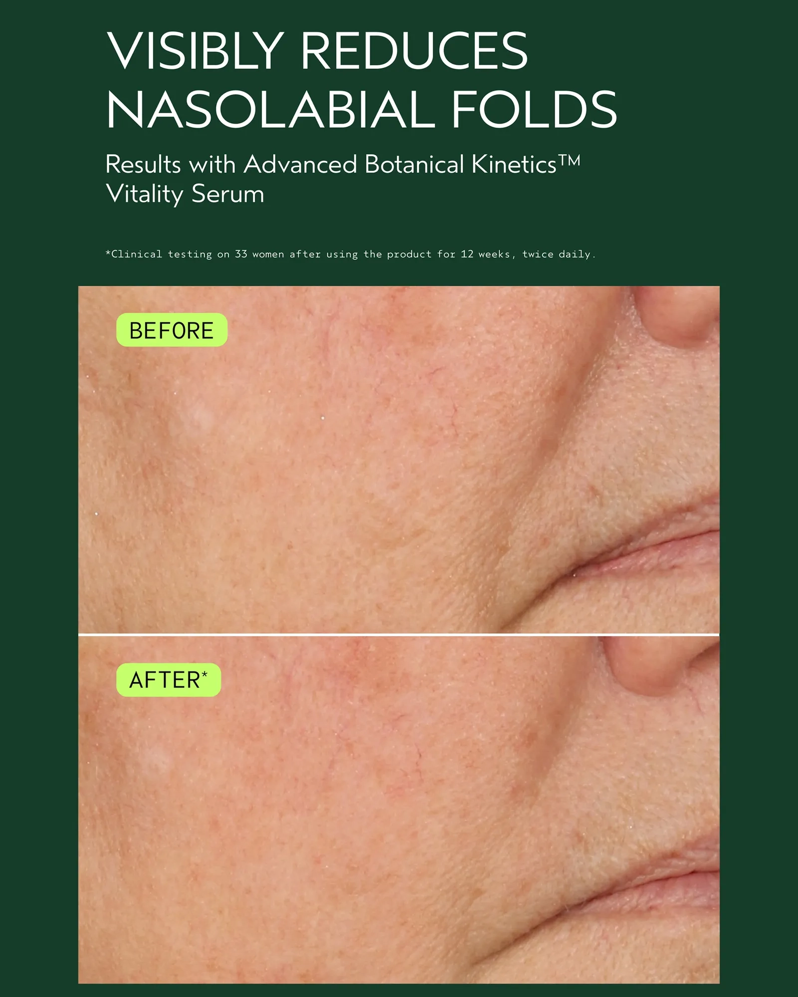 Alternative Image AVEDA Advanced Kinetics Vitality Serum