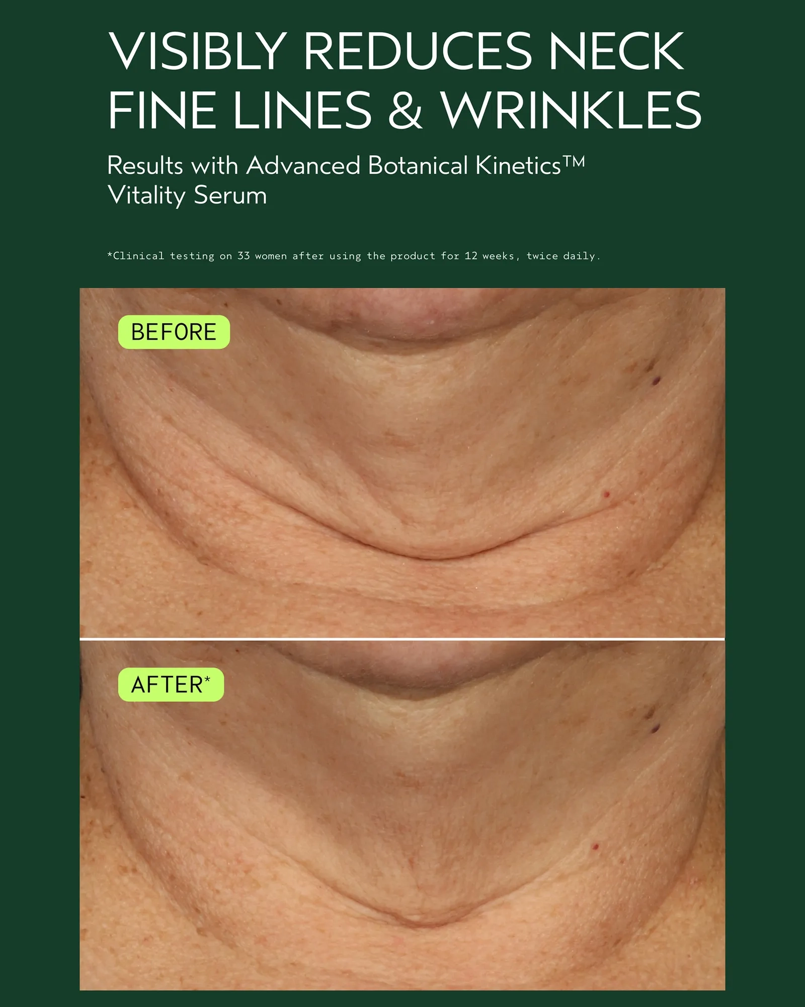 Alternative Image AVEDA Advanced Kinetics Vitality Serum