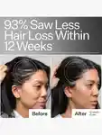 Alternative Image Act Acre Stem Cell Peptide Scalp Treatment
