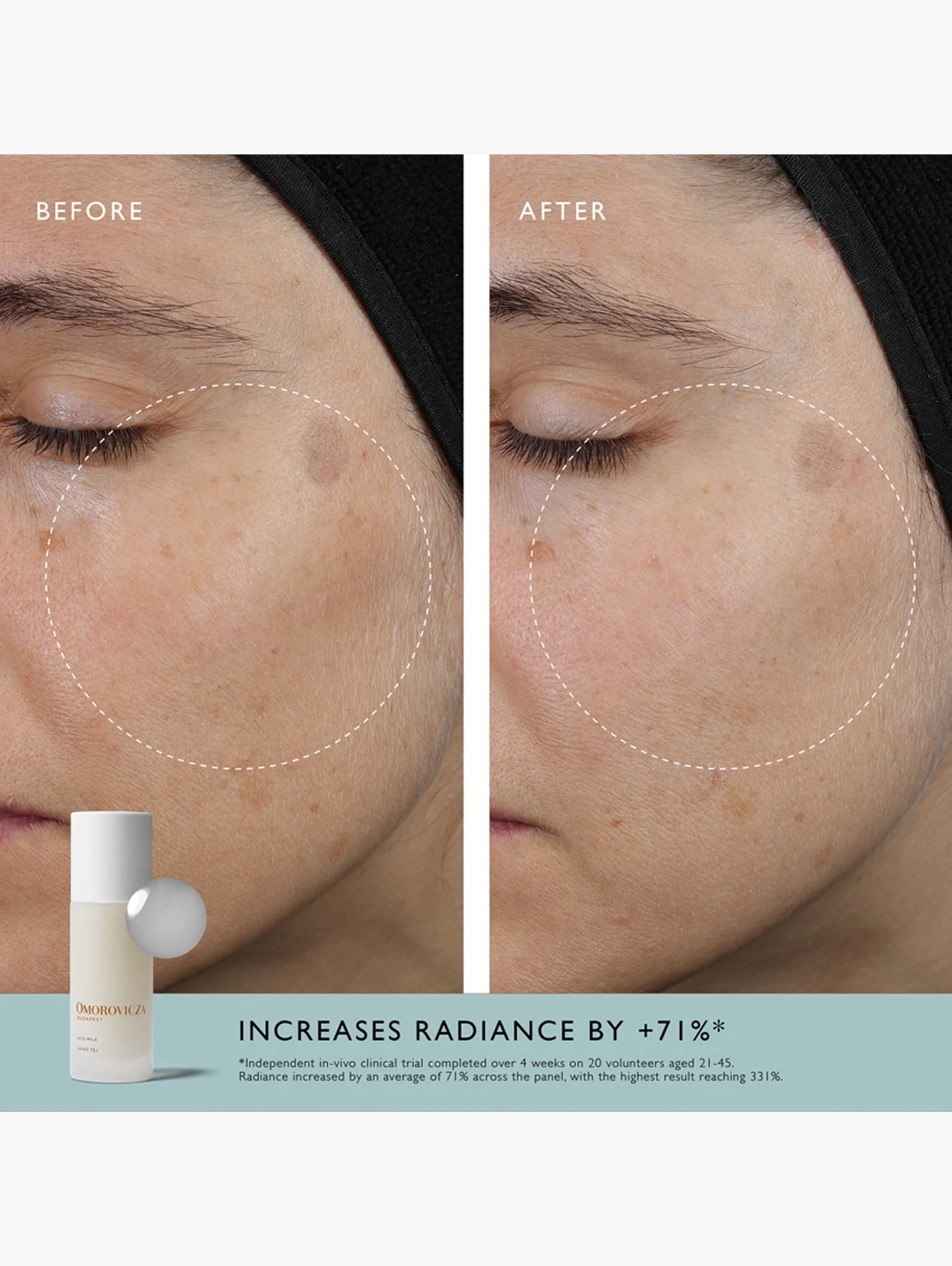 Alternative Image OMOROVICZA Acid Milk
