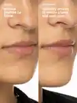 Alternative Image Rhode Peptide Lip Boost