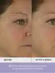 Alternative Image TATCHA The Dewy Skin Cream15m L