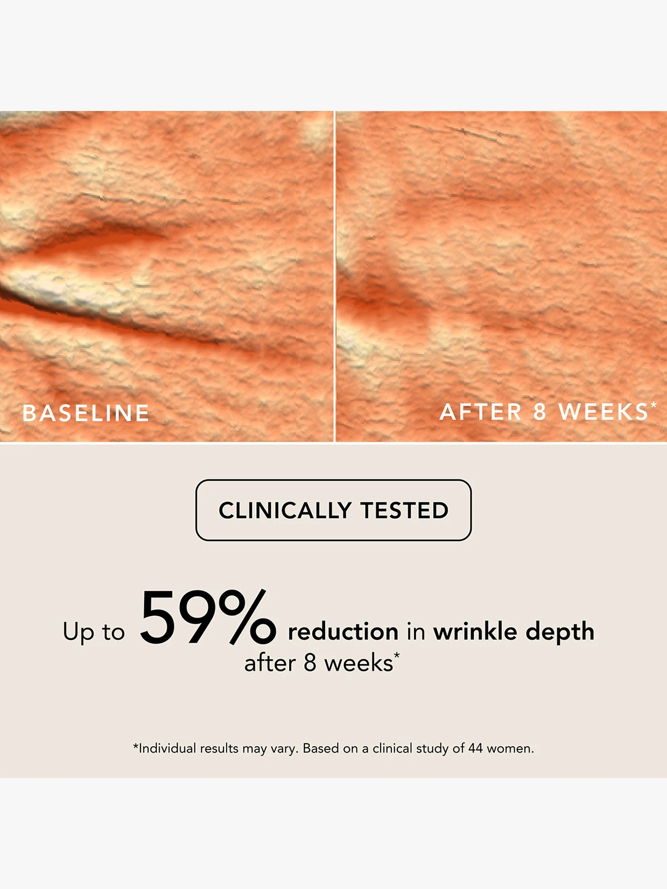 Alternative Image Chantecaille Bio Lifting Concealer