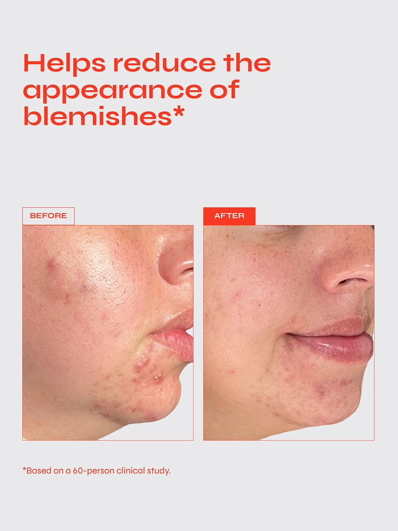 Alternative Image FACILE Clear Serum Exfoliating Serum For Blemishes With10 Aha Bha Blend