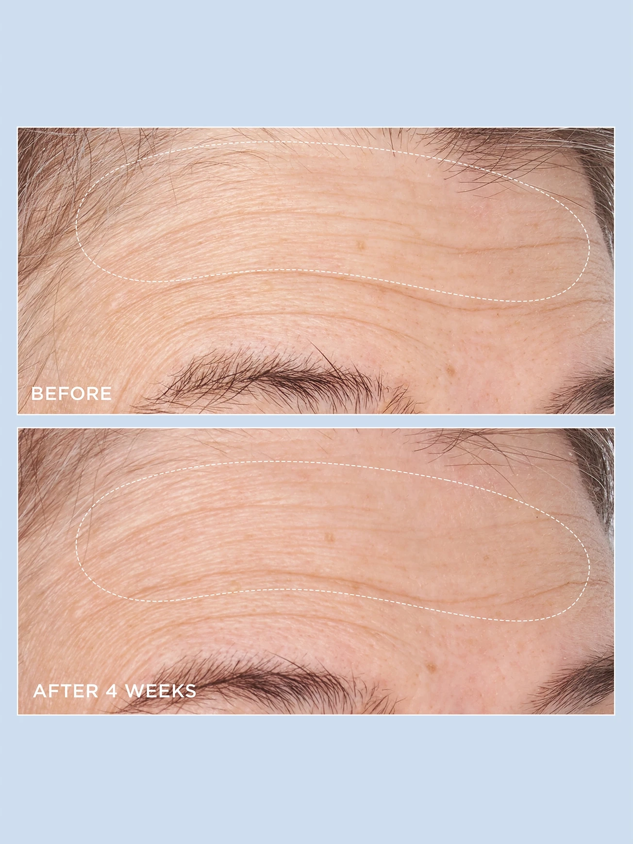 Alternative Image PERRICONEMD Cold Plasma Plus Advanced Hydrating Complex