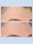 Alternative Image PERRICONEMD Cold Plasma Plus Advanced Hydrating Complex